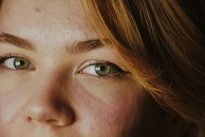Link Between Stress and Stubborn Skin