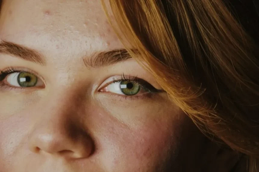 Link Between Stress and Stubborn Skin